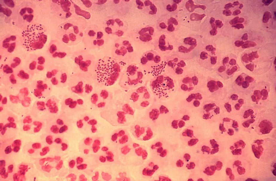 Bactéria 'Neisseria gonorrhoeae', causadora da gonorreia, infecção sexualmente transmissível (CDC/ Joe Millar)