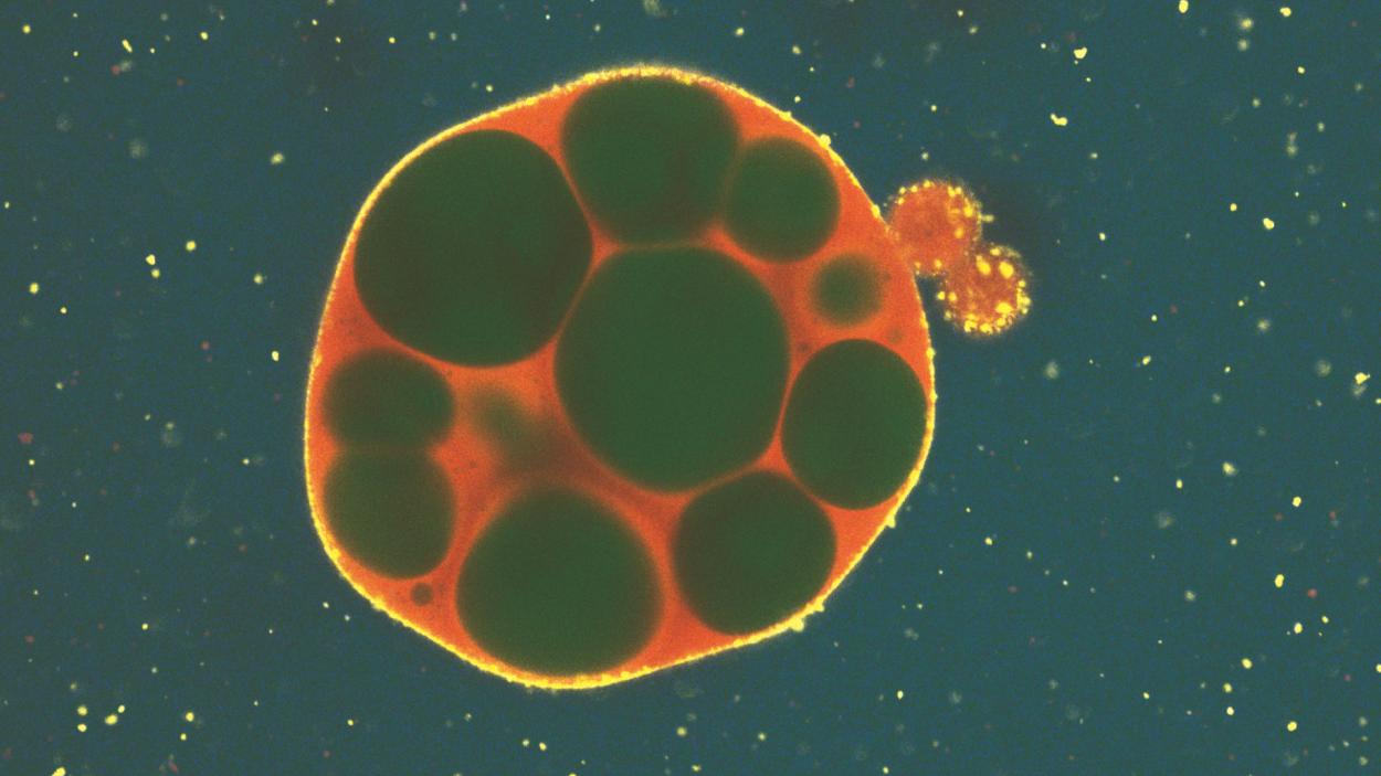 Poucas mutações fazem estruturas simples de RNA ganhar movimento e até espaço para armazenar carga 1 Gotícula sintética de RNA com vacúolos formados após a introdução de mutações no DNA usado como molde. (Crédito: William Verstraeten / Nature Chemical Engineering — CC BY 4.0.)