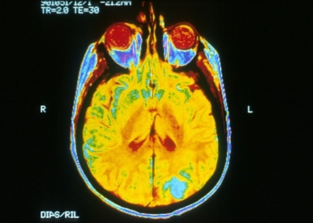 Respiração intensa reduziu em 45,5% o fluxo sanguíneo da massa cinzenta em estudo 1 Imagem ilustrativa de ressonância magnética do cérebro. O novo estudo analisou alterações no fluxo sanguíneo cerebral durante técnica de respiração intensa. (National Cancer Institute / NIH — imagem em domínio público)